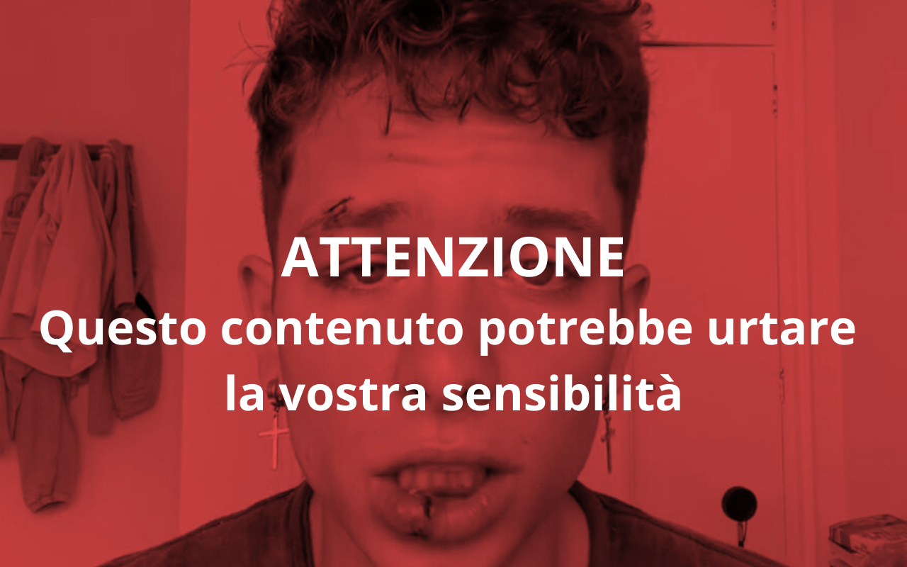 Joe De La Torre, creator di OnlyFans aggredito: insulti omofobi e pugni mentre girava video TikTok