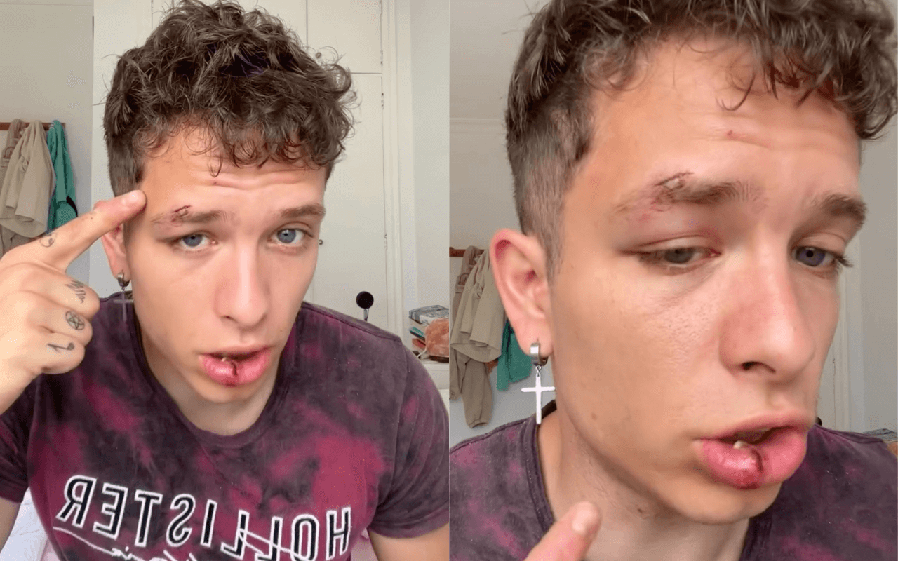 Joe De La Torre, creator di OnlyFans vittima di aggressione omofoba