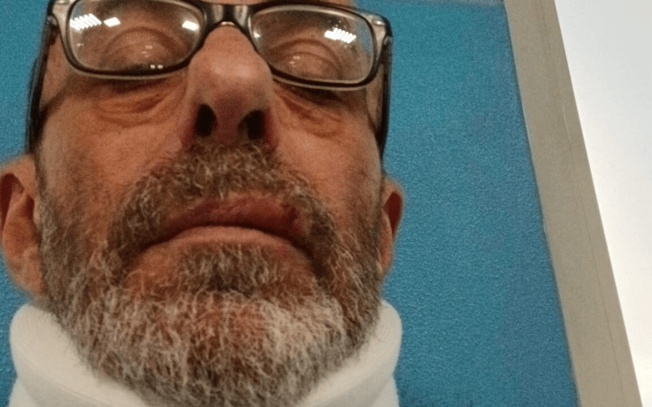 Ristoratore picchiato: fonte foto ValsusaOggi