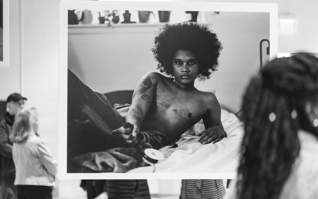Lindsay Perryman e “TOPS”: la fotografia sulla top surgery e la comunità transmasc