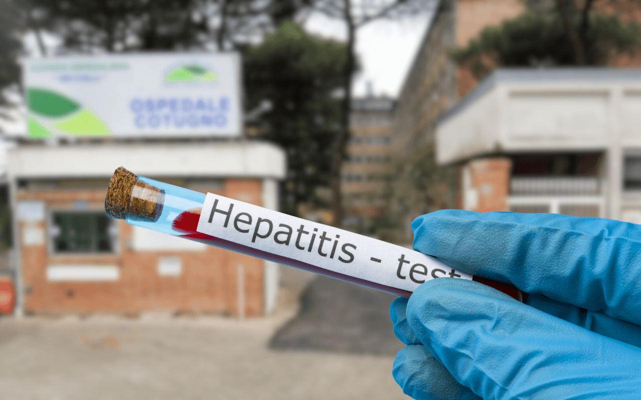 Epatite A a Napoli e in Campania, casi in aumento anche a Latina: l’appello di Arcigay su prevenzione e vaccino per la popolazione MSM