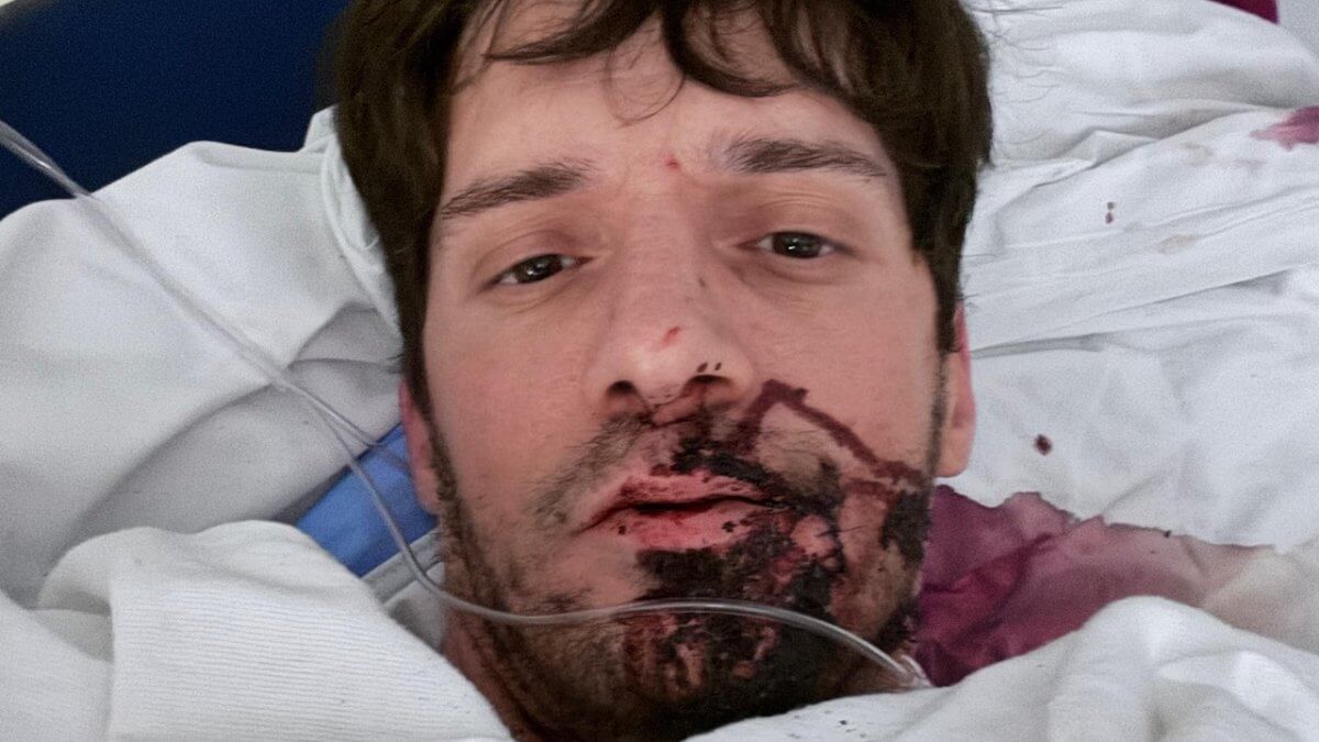 Ty Roderick, il pornodivo queer accoltellato e in ospedale: “Un attacco brutale e terrificante”