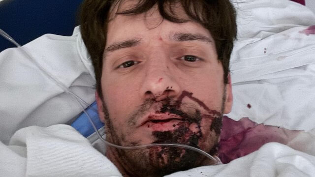 Ty Roderick, il pornodivo queer accoltellato e in ospedale: "Un attacco brutale e terrificante" - Ty Roderick accoltellato - Gay.it