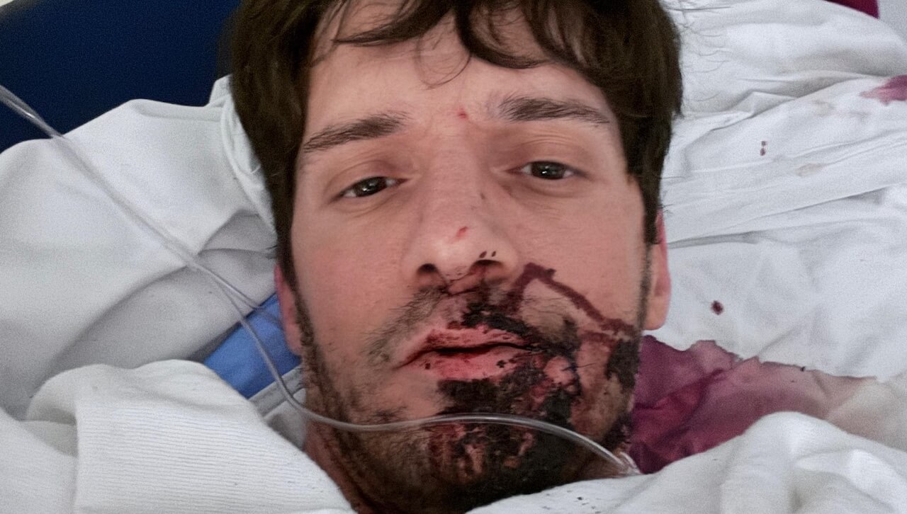 Ty Roderick, il pornodivo queer accoltellato e in ospedale: “Un attacco brutale e terrificante”