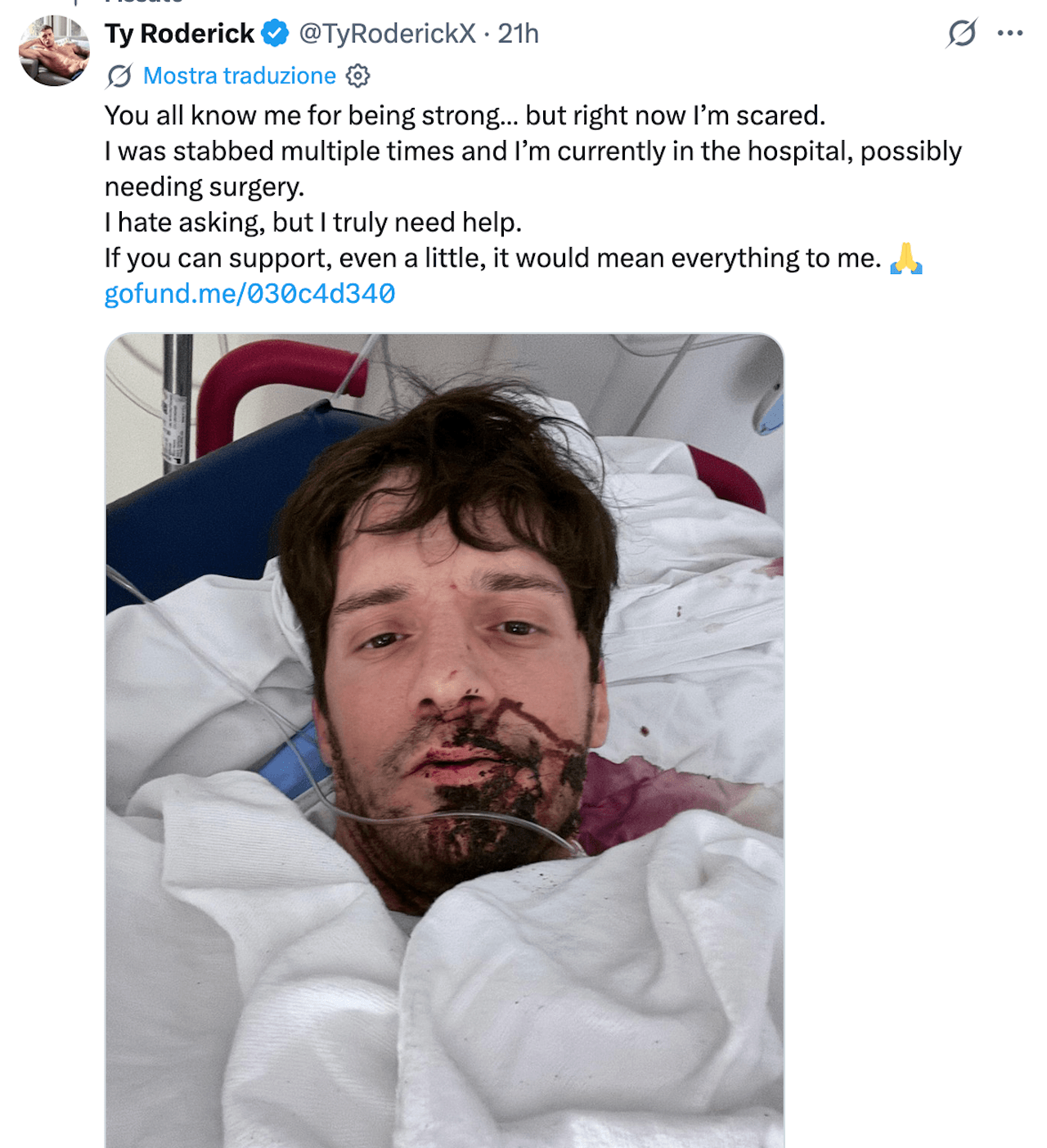 Ty Roderick, il pornodivo queer accoltellato e in ospedale: "Un attacco brutale e terrificante" - Ty Roderick - Gay.it