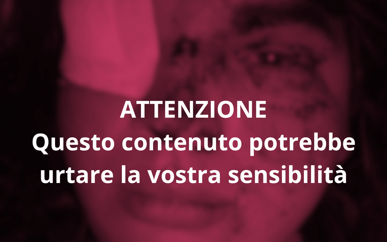 Spagna, Bianca Fernández, donna trans, massacrata da 5 ragazze: “Bottiglie e calci in faccia. La mia corona è il mio coraggio”
