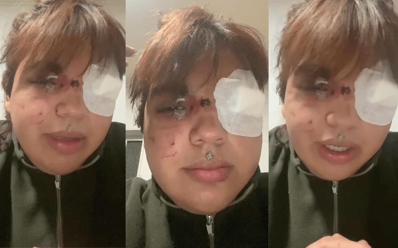 Spagna, Bianca Fernández, donna trans, massacrata da 5 ragazze: “Bottiglie e calci in faccia. La mia corona è il mio coraggio" - bianca - Gay.it